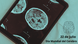 Día Mundial del Cerebro en IRCA radiocirugía 22 julio