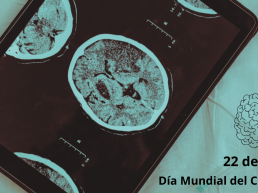 Día Mundial del Cerebro en IRCA radiocirugía 22 julio