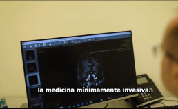 la medicina minimamente invasiva zap-x medicina no invasiva