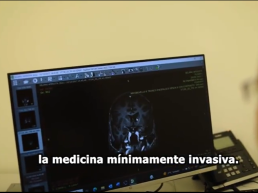 la medicina minimamente invasiva zap-x medicina no invasiva