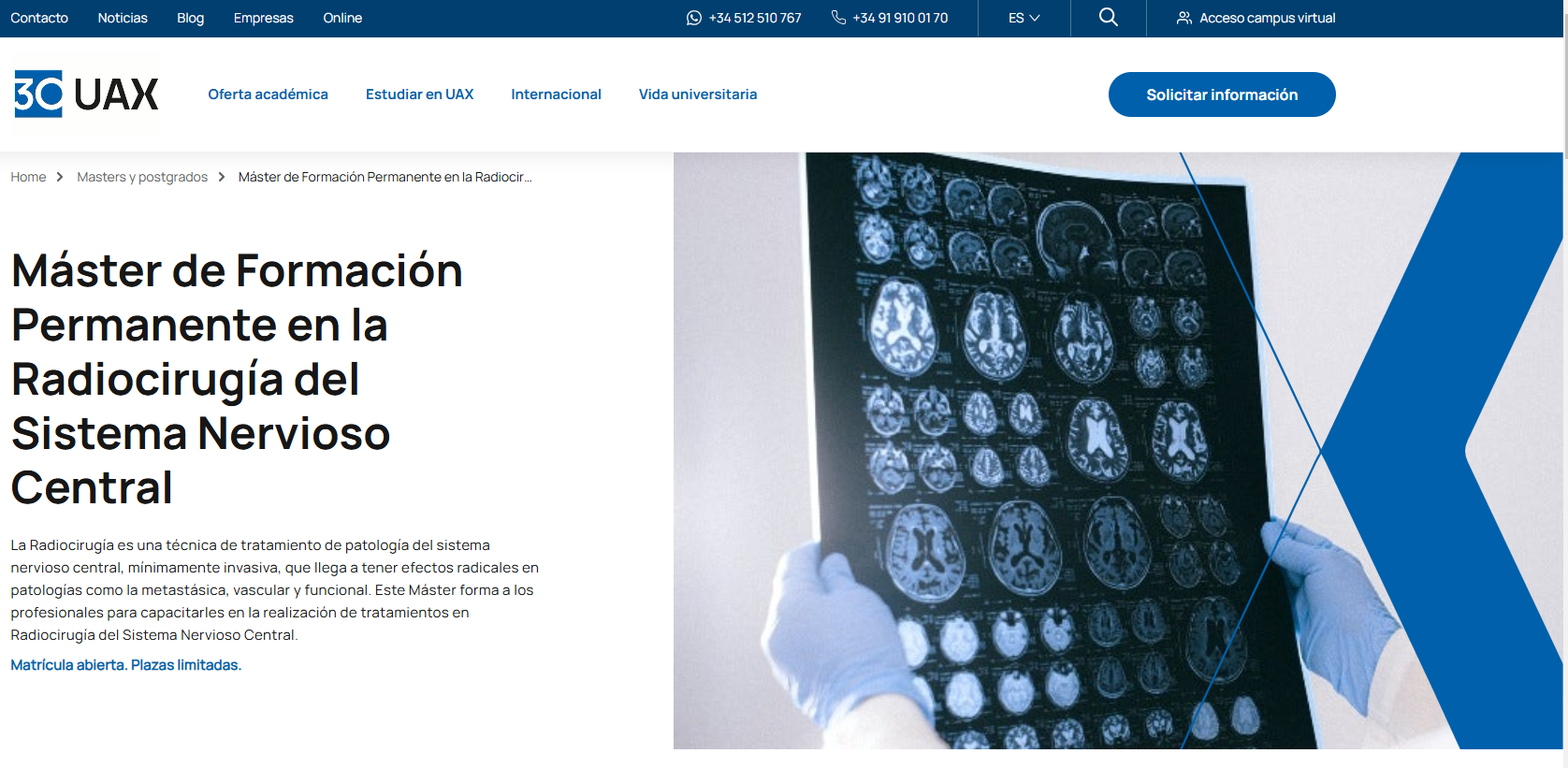 Máster Internacional en Radiocirugía del SNC pagina de la UAX